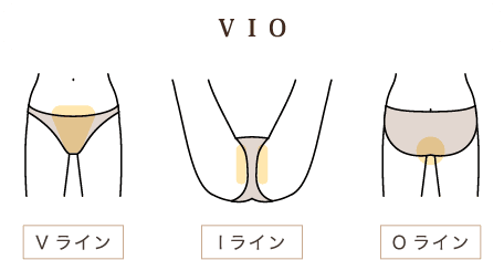 VIO