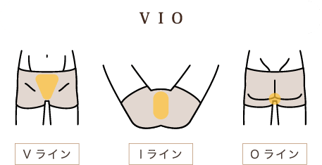 VIO